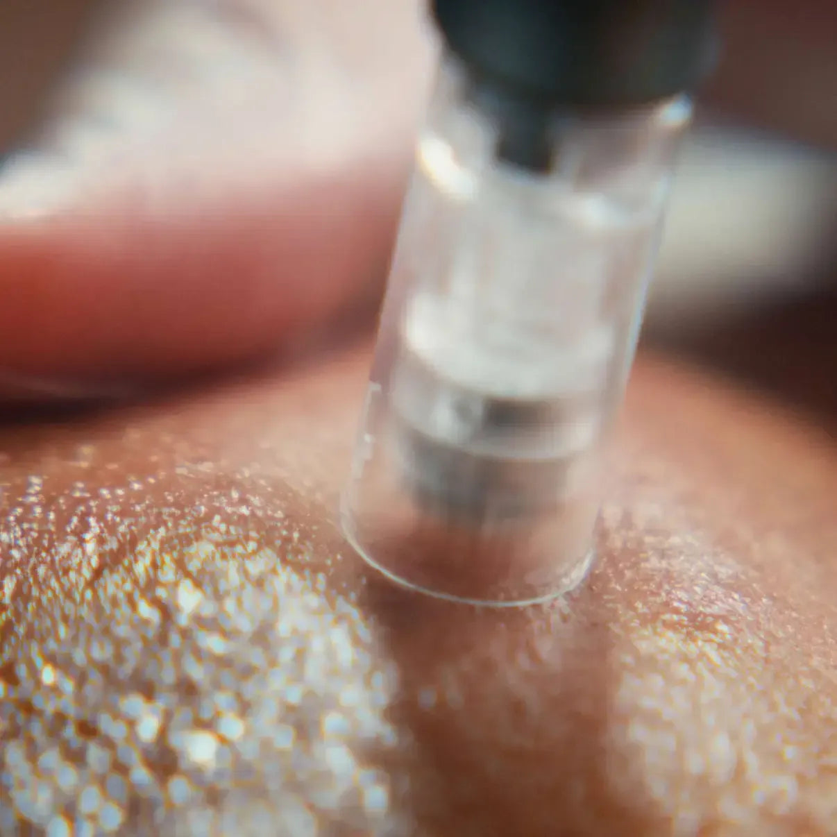 Nano & Microneedling