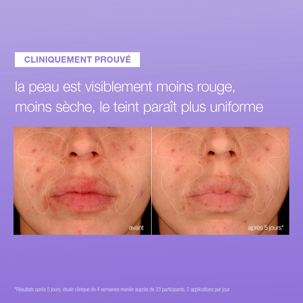 Stabilizing Repair Serum